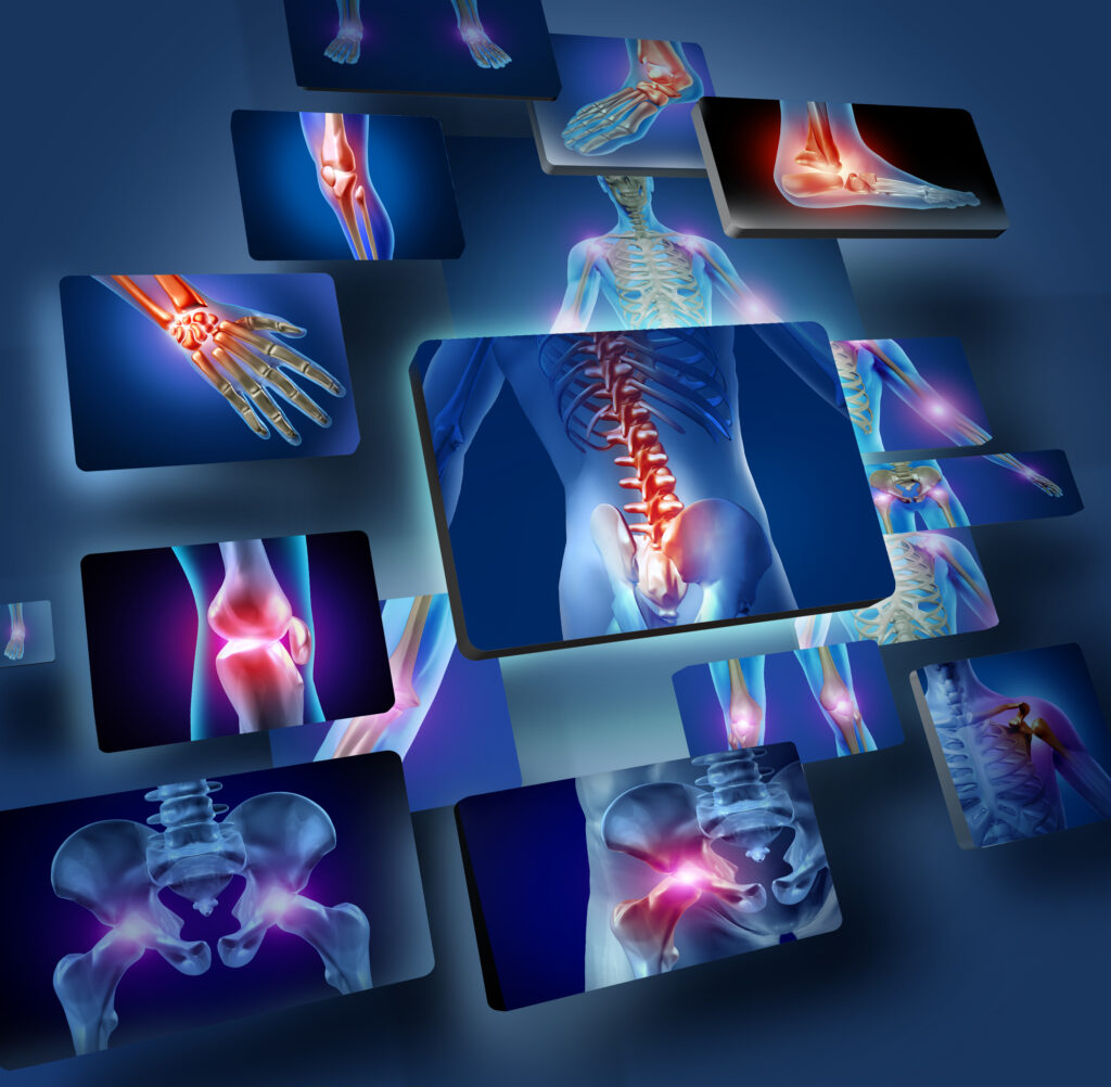 Physical therapy for joint pain